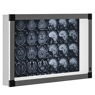 Negatoscope device for viewing X-ray images 2